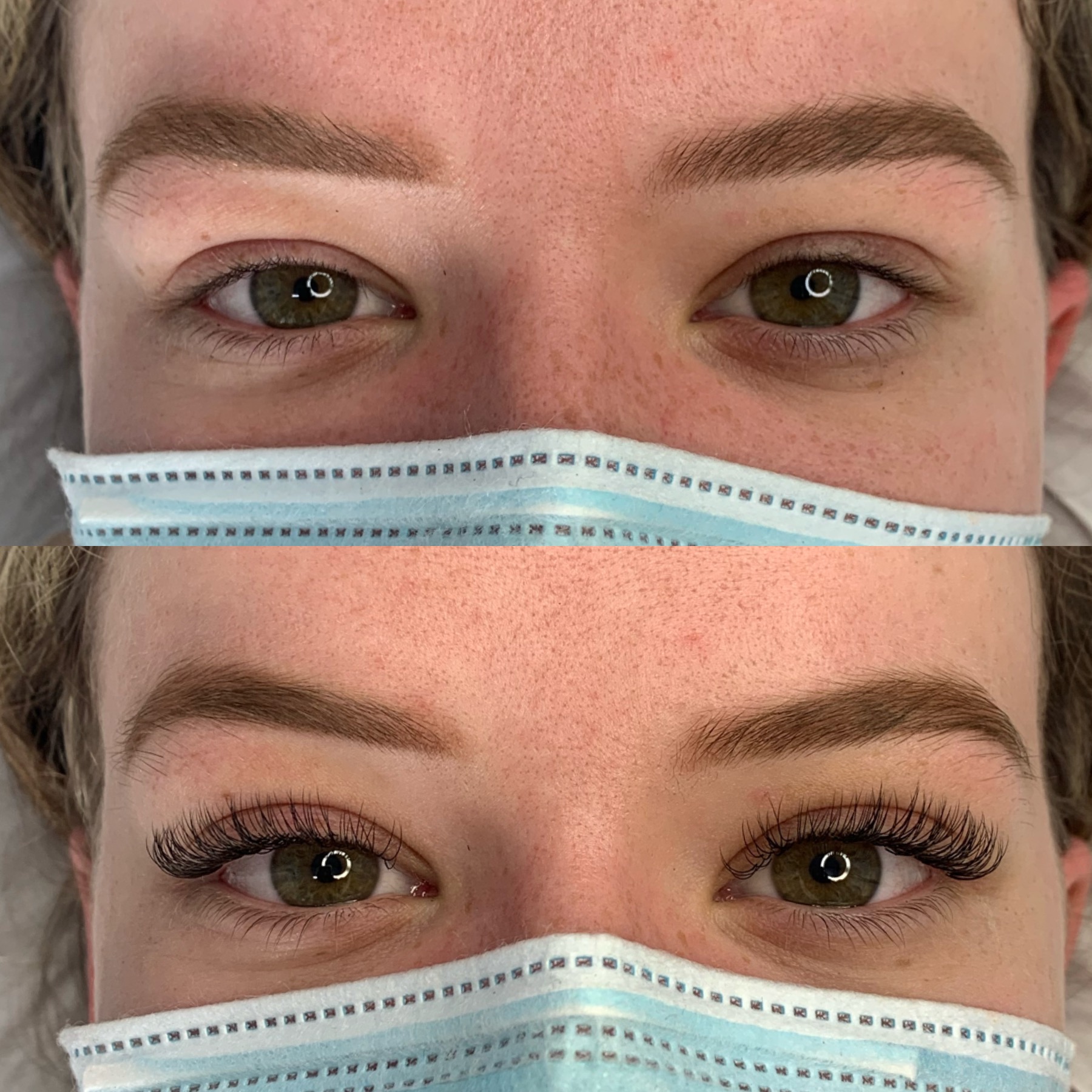 Before and after: the same eyes photographed before and after treatment